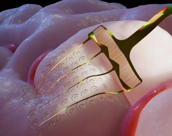 特稿：惠及6000多名殘疾人 中國腦機接口技術持續突破